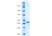 Recombinant Human Interleukin-11 thumbnail image 2