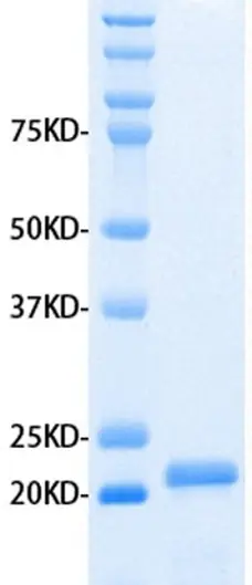 Recombinant Human MMP-3 gallery image 1