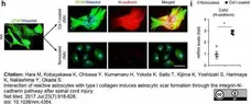 Native Collagen I (Tail Tendon) gallery image 1