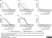 Recombinant Dengue Virus Type 4 NS1 Antigen thumbnail image 1