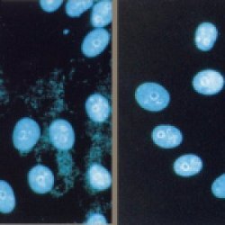Mycoplasma Removal Agent gallery image 1